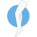 Varices
