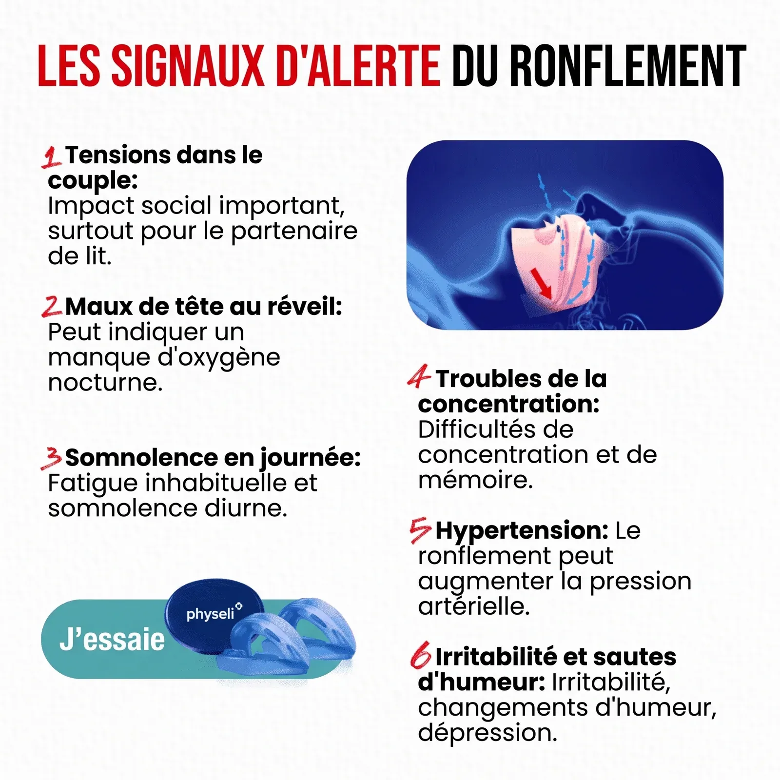 Dormex | Gouttière anti-ronflement