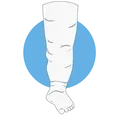 Lymphœdème