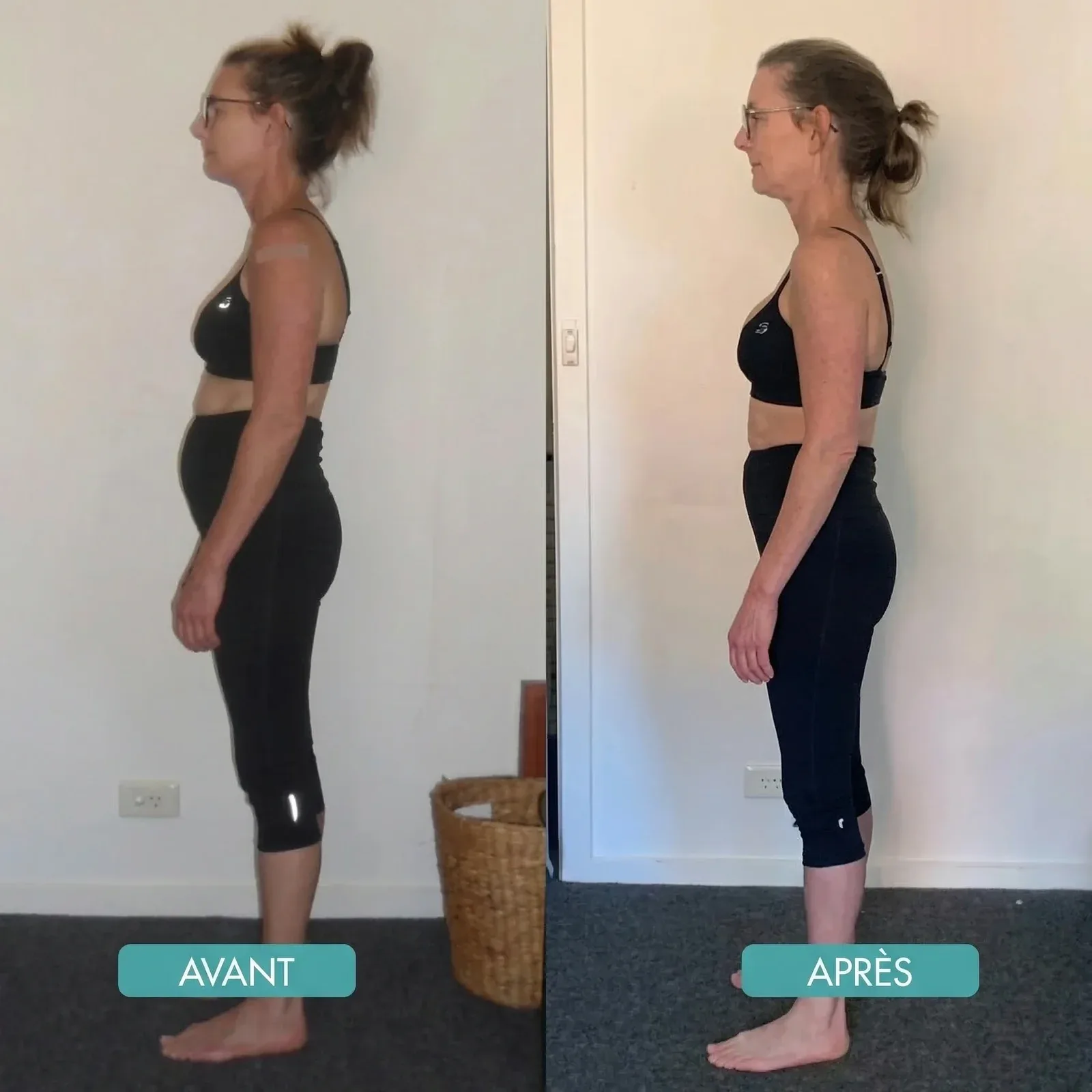 BackAlign | Correcteur de posture instantané